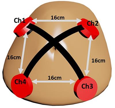 A Comparative Study on Fetal <mark class="highlighted">Heart Rates</mark> Estimated from Fetal Phonography and Cardiotocography